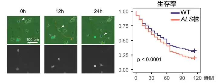 慶應義塾大学と東京大学がiPS細胞からの運動ニューロン誘導法を開発、ALSの病態解明に向け新たな一歩