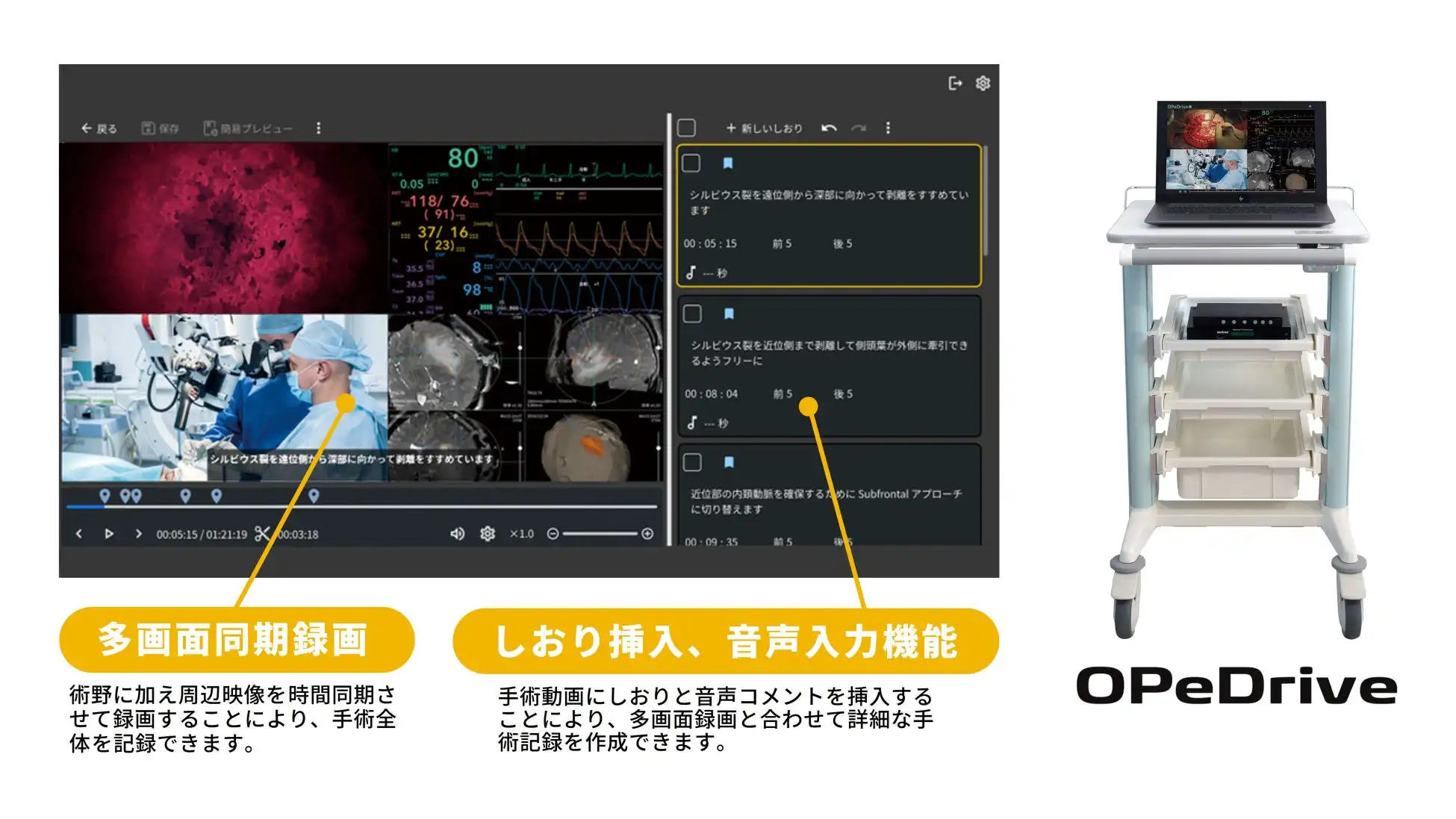 医学生に選ばれた手術教育ツールOPeDrive、宮崎大学での導入により教育効率が大幅に向上